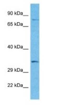 Western Blot: SNX29 Antibody [NBP3-09243] - Western blot analysis of SNX29 in 721_B Whole Cell lysates. Antibody dilution at 1.0ug/ml