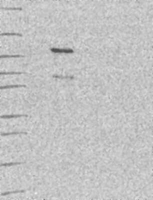Western Blot: SNX29 Antibody [NBP3-17935] - Lane 1: Marker [kDa] 250, 130, 95, 72, 55, 36, 28, 17, 10;   Lane 2: RT4;   Lane 3: U-251 MG;   Lane 4: Human Plasma;   Lane 5: Liver;   Lane 6: Tonsil