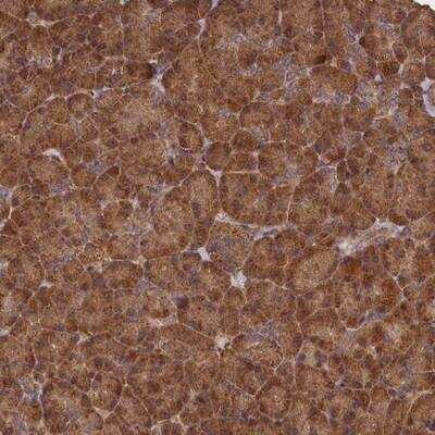 Immunohistochemistry: SNX33 Antibody [NBP1-81125] - Immunohistochemical staining of human pancreas shows strong cytoplasmic positivity in exocrine glandular cells and islets of Langerhans.