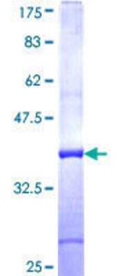 SDS-Page: SNX33 Partial Recombinant Protein [h00257364-Q01] - 12.5% SDS-PAGE Stained with Coomassie Blue.