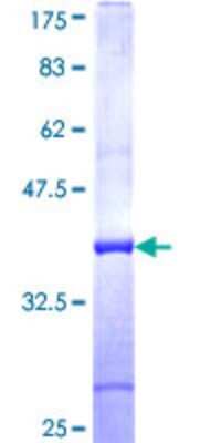 Western Blot: SNX33 Partial Recombinant Protein [h00257364-Q01]
