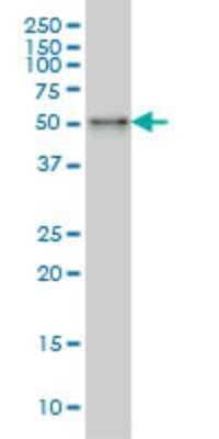 Western Blot: SNX4 Antibody (4H8) [H00008723-M01] - SNX4 monoclonal antibody (M01), clone 4H8 Analysis of SNX4 expression in A-431.