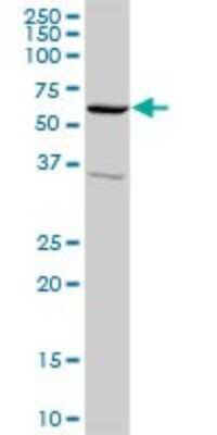 Western Blot: SNX4 Antibody [H00008723-D01P] - Analysis of SNX4 expression in human liver.