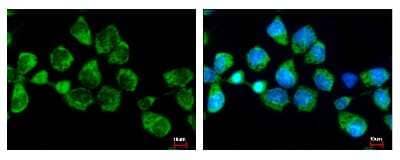 Immunocytochemistry/ Immunofluorescence SNX5 Antibody