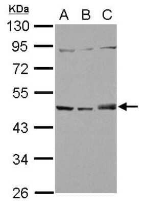 Western Blot SNX5 Antibody