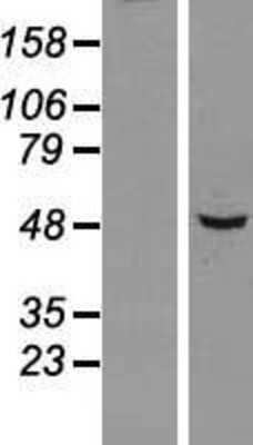 Western Blot SNX5 Overexpression Lysate