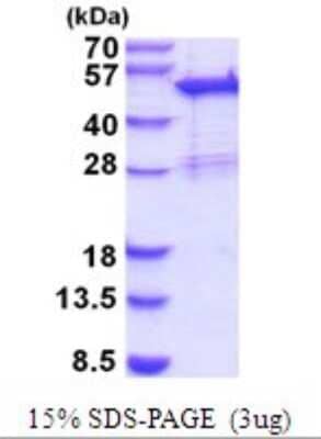 SDS-PAGE Recombinant Human SNX5 His Protein