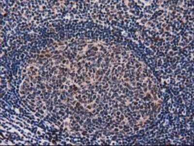 Immunohistochemistry-Paraffin: SNX8 Antibody (1E5) [NBP2-03367] - Staining of paraffin-embedded Human lymph node tissue using anti-SNX8 mouse monoclonal antibody.