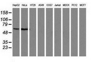 Western Blot: SNX8 Antibody (1E5) [NBP2-03367] Analysis of extracts (35ug) from 9 different cell lines by using anti-SNX8 monoclonal antibody.