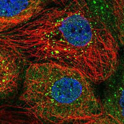 Immunocytochemistry/Immunofluorescence: SNX8 Antibody [NBP2-31672] - Immunofluorescent staining of human cell line A-431 shows localization to vesicles.