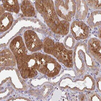 Immunohistochemistry-Paraffin: SNX8 Antibody [NBP2-31672] - Staining of human kidney shows strong cytoplasmic positivity in cells in tubules.