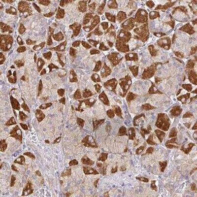 Immunohistochemistry-Paraffin: SNX8 Antibody [NBP2-31808] - Staining of human stomach, upper shows strong cytoplasmic positivity in glandular cells.