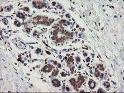 Immunohistochemistry: SNX8 Antibody (OTI1A1) - Azide and BSA Free [NBP2-74265] - Analysis of Human breast tissue.