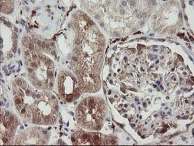 Immunohistochemistry: SNX8 Antibody (OTI1A1) - Azide and BSA Free [NBP2-74265] - Analysis of Human Kidney tissue.