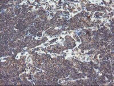 Immunohistochemistry: SNX8 Antibody (OTI1A1) - Azide and BSA Free [NBP2-74265] - Analysis of Human lymphoma tissue.