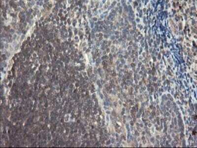 Immunohistochemistry: SNX8 Antibody (OTI1A1) [NBP2-45896] - Analysis of Human tonsil tissue.