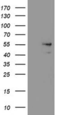 Western Blot: SNX8 Antibody (OTI1A1) [NBP2-45896] - Analysis of HEK293T cells were transfected with the pCMV6-ENTRY control (Left lane) or pCMV6-ENTRY SNX8.