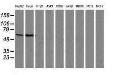 Western Blot: SNX8 Antibody (OTI1E5) - Azide and BSA Free [NBP2-74266] - Analysis of extracts (35ug) from 9 different cell lines by using anti-SNX8 monoclonal antibody.