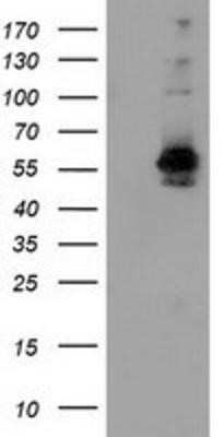Western Blot: SNX8 Antibody (OTI1E5) - Azide and BSA Free [NBP2-74266] - HEK293T cells were transfected with the pCMV6-ENTRY control (Left lane) or pCMV6-ENTRY SNX8 (Right lane) cDNA for 48 hrs and lysed. Equivalent amounts of cell lysates (5 ug per lane) were separated by SDS-PAGE and immunoblotted with anti-SNX8.