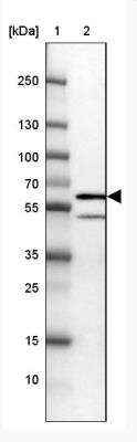 Western Blot: SNX8 Antibody [NBP2-31672] - Lane 1: Marker [kDa] 250, 130, 100, 70, 55, 35, 25, 15, 10Lane 2: Human cell line U-2 OS