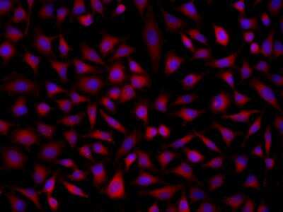 Immunocytochemistry/Immunofluorescence: SOAT 2 Antibody [NBP3-06319] - Immunofluorescence staining of SOAT2 in Hela cells. Cells were fixed with 4% PFA, permeabilzed with 0.1% Triton X-100 in PBS,blocked with 10% serum, and incubated with rabbit anti-Human SOAT2 polyclonal antibody (dilution ratio 1:200) at 4 degrees celsius overnight. Then cells were stained with the Alexa Fluor (TM) 594-conjugated Goat Anti-rabbit IgG secondary antibody (red) and counterstained with DAPI (blue).Positive staining was localized to Cytoplasm.