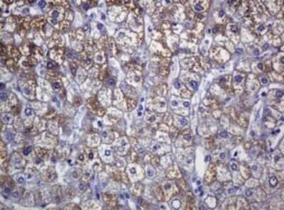 Immunohistochemistry: SOAT 2 Antibody (OTI2D3) - Azide and BSA Free [NBP2-74271] - Analysis of Human liver tissue. (Heat-induced epitope retrieval by 10mM citric buffer, pH6.0, 120C for 3min)