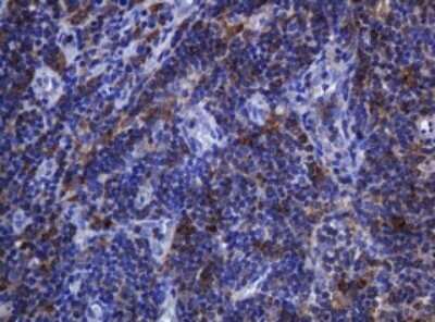 Immunohistochemistry: SOAT 2 Antibody (OTI2D3) - Azide and BSA Free [NBP2-74271] - Analysis of Human lymph node tissue. (Heat-induced epitope retrieval by 10mM citric buffer, pH6.0, 120C for 3min)