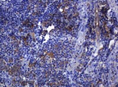 Immunohistochemistry: SOAT 2 Antibody (OTI2D3) - Azide and BSA Free [NBP2-74271] - Analysis of Human tonsil tissue. (Heat-induced epitope retrieval by 10mM citric buffer, pH6.0, 120C for 3min)