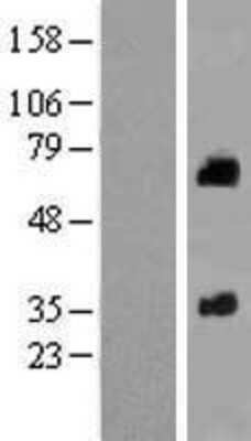 Western Blot: SOAT 2 Overexpression Lysate (Adult Normal) [NBP2-10598] Left-Empty vector transfected control cell lysate (HEK293 cell lysate); Right -Over-expression Lysate for SOAT 2.