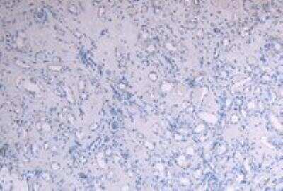 Immunohistochemistry-Paraffin SOCS-1 Antibody