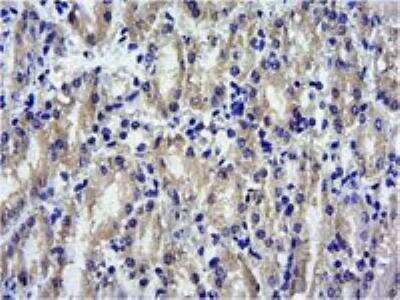 Immunohistochemistry-Paraffin SOCS-1 Antibody