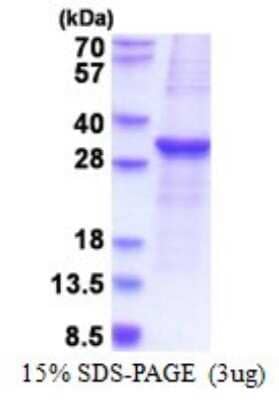 SDS-Page: SOCS-3 Recombinant Protein [NBP2-51603] - 15% SDS Page (3 ug)