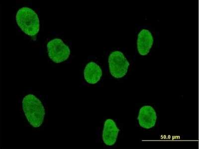 Immunocytochemistry/Immunofluorescence: SOCS-4 Antibody [H00122809-B01P] - Analysis of purified antibody to SOCS4 on HeLa cell. (antibody concentration 10 ug/ml)