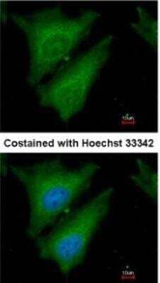 Immunocytochemistry/Immunofluorescence: SOCS-4 Antibody [NBP1-31007] -  Paraformaldehyde-fixed HeLa, using antibody at 1:200 dilution.