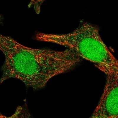 Immunocytochemistry/Immunofluorescence: SOCS-4 Antibody [NBP2-58238] - Staining of human cell line A549 shows localization to nucleus & cytosol.