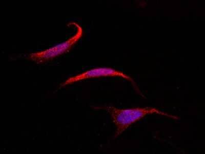 Immunocytochemistry/Immunofluorescence: SOCS-4 Antibody [NBP2-98875] - Immunofluorescence staining of SOCS-4 in HeLa cells. Cells were fixed with 4% PFA, blocked with 10% serum, and incubated with rabbit anti-human SOCS-4 polyclonal antibody (1:1000) at 4C overnight. Then cells were stained with the Alexa Fluor(R)594-conjugated Goat Anti-rabbit IgG secondary antibody (red) and counterstained with DAPI (blue). Positive staining was localized to cytoplasm.