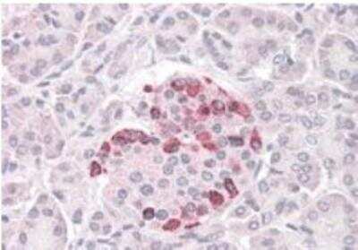 Immunohistochemistry-Paraffin: SOCS-4 Antibody [NB100-898] -  3.8ug/ml staining of paraffin embedded Human Pancreas. Steamed antigen retrieval with citrate buffer pH 6, AP-staining.