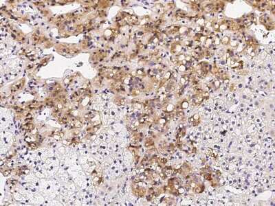 Immunohistochemistry-Paraffin: SOCS-4 Antibody [NBP2-98875] - Immunochemical staining of human SOCS-4 in human adrenal gland with rabbit polyclonal antibody (1:2000, formalin-fixed paraffin embedded sections).