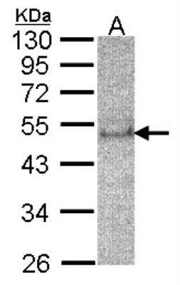 Western Blot: SOCS-4 Antibody [NBP1-31007] -  Sample(30 ug of whole cell lysate)A:HeLa S3 12% SDS PAGE, antibody diluted at 1:200.