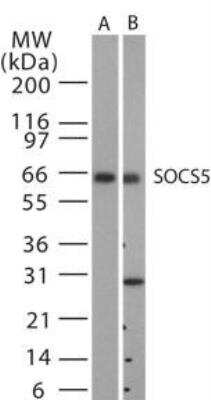 Western Blot SOCS-5 Antibody