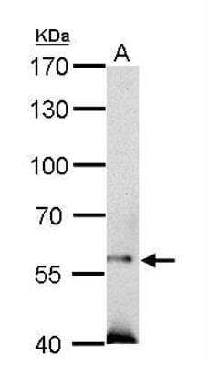Western Blot: SOCS-5 Antibody [NBP1-30990] - A. 50 ug mouse testis lysate/extract  7.5 % SDS-PAGE SOCS5 antibody dilution: 1:500