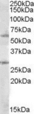 Western Blot: SOCS-7/Nck/NAP4 Antibody [NBP1-06994] - Analysis of SOCS7-7/Nck/NAP4 in Daudi lysate (35ug protein in RIPA buffer) using NBP1-06994 at 1ug/ml. Primary incubation was 1 hour. Detected by chemiluminescence.