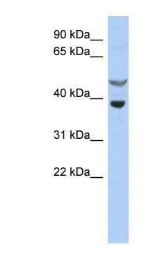 Western Blot: SOCS-7/Nck/NAP4 Antibody [NBP1-58902] - OVCAR-3 cell lysate.