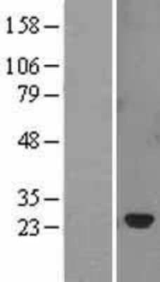 Western Blot: SOCS2 Overexpression Lysate (Adult Normal) [NBL1-16326] Left-Empty vector transfected control cell lysate (HEK293 cell lysate); Right -Over-expression Lysate for SOCS2.