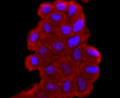 Immunocytochemistry/Immunofluorescence: SOD1/Cu-Zn SOD Antibody (JF1005) [NBP2-67158] - Staining SOD1 in Hela cells (red). The nuclear counter stain is DAPI (blue). Cells were fixed in paraformaldehyde, permeabilised with 0.25% Triton X100/PBS.