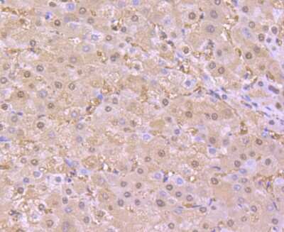 Immunohistochemistry-Paraffin: SOD1/Cu-Zn SOD Antibody (JF1005) [NBP2-67158] - Analysis of paraffin-embedded human liver tissue using anti-SOD1 antibody. Counter stained with hematoxylin.