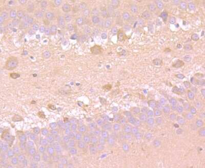 Immunohistochemistry-Paraffin: SOD1/Cu-Zn SOD Antibody (JF1005) [NBP2-67158] - Analysis of paraffin-embedded rat brain tissue using anti-SOD1 antibody. Counter stained with hematoxylin.