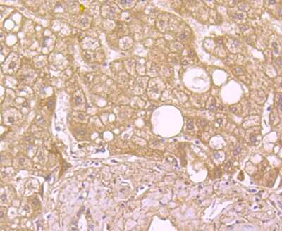Immunohistochemistry-Paraffin: SOD2/Mn-SOD Antibody (JJ089-02) [NBP2-67879] - Analysis of paraffin-embedded human liver tissue using anti-SOD2 antibody. Counter stained with hematoxylin.