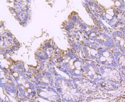 Immunohistochemistry-Paraffin: SOD2/Mn-SOD Antibody (JJ089-02) [NBP2-67879] - Analysis of paraffin-embedded mouse colon tissue using anti-SOD2 antibody. Counter stained with hematoxylin.