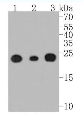 Western Blot: SOD2/Mn-SOD Antibody (JJ089-02) [NBP2-67879] - Analysis of SOD2 on different lysates. Proteins were transferred to a PVDF membrane and blocked with 5% BSA in PBS for 1 hour at room temperature. The primary antibody (1/500) was used in 5% BSA at room temperature for 2 hours. Goat Anti-Rabbit IgG - HRP Secondary Antibody at 1:5,000 dilution was used for 1 hour at room temperature. Positive control: Lane 1: mouse brain tissue lysateLane 2: SH-SY5Y cell lysate Lane 3: mouse heart tissue lysate